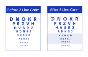 vision eye chart