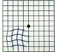 1774301270_macular-line-test macular line test